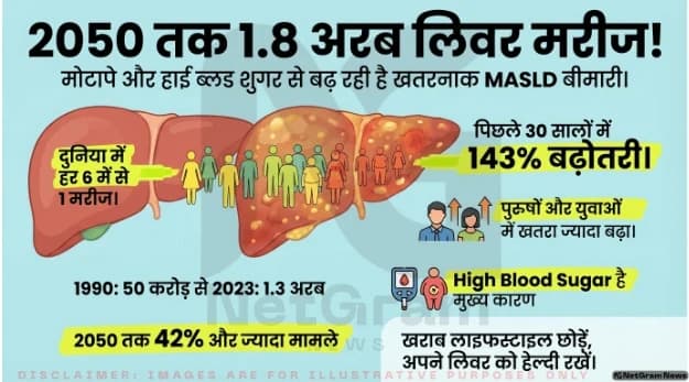 2050 तक 1.8 अरब लोगों को हो सकती है लिवर की खतरनाक बीमारी MASLD