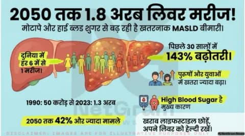 2050 तक 1.8 अरब लोगों को हो सकती है लिवर की खतरनाक बीमारी MASLD